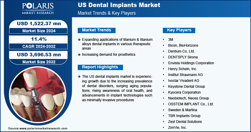 U.S. Dental Implants Market size